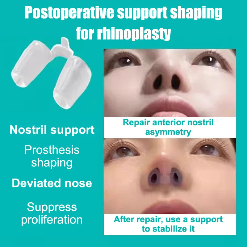 Postoperative Rhinoplasty Nostril Support Silicone Shaping Crooked Nose Correction Fixator Silica Gel Nose Clip